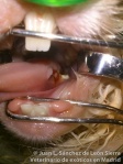 Laceración y úlcera lingual